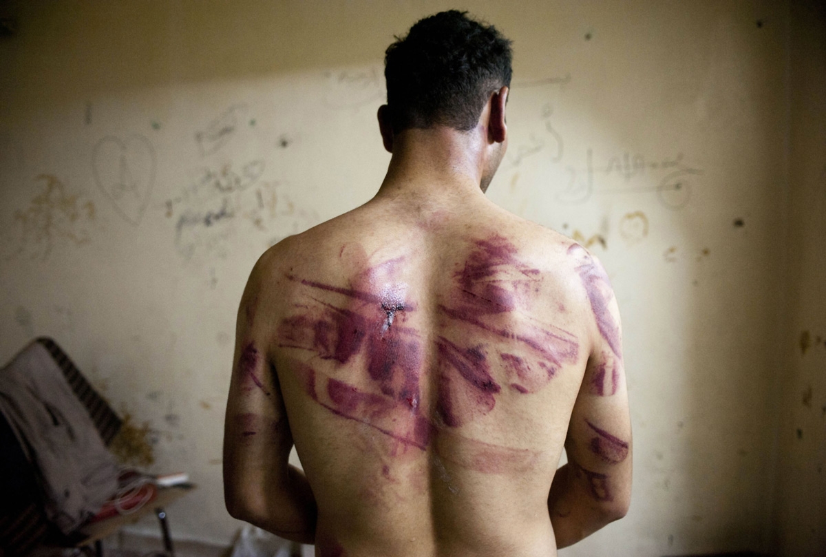 syria-torture